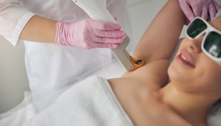 Laser hair removal
